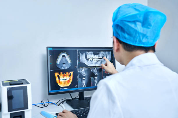 Best Emergency Root Canal Treatment in Milwaukee, WI
